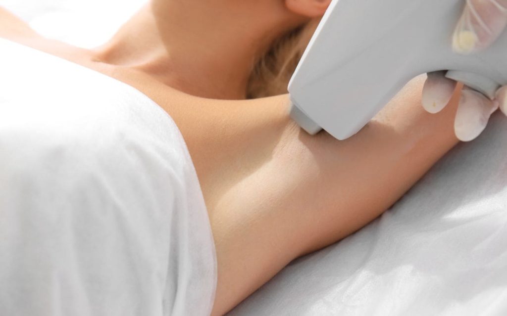 Épilation définitive au laser