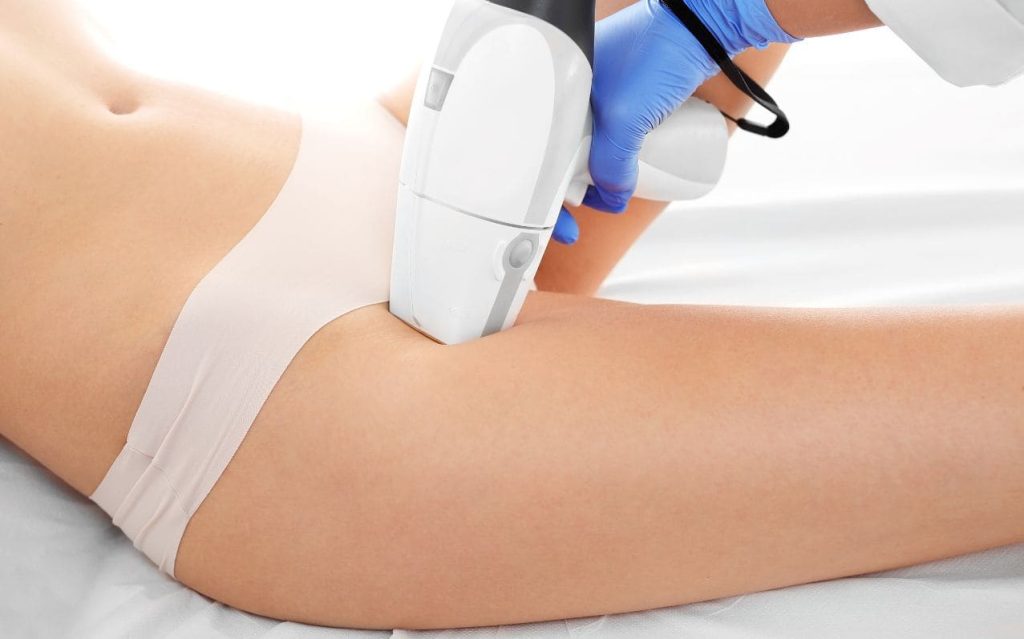 Épilation définitive au laser